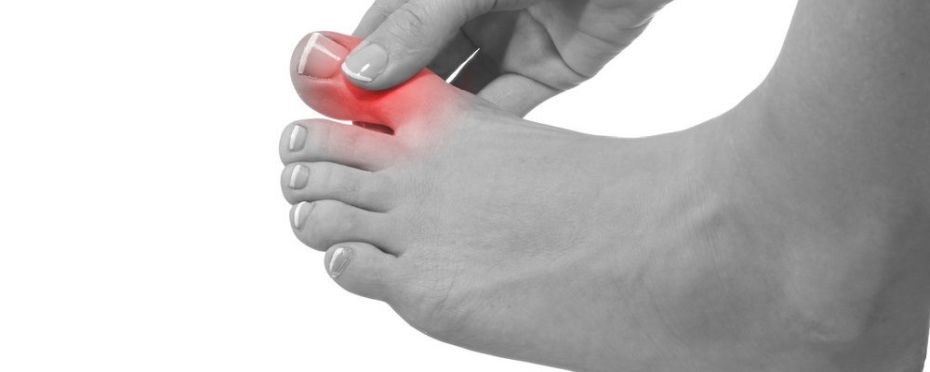 Hallux? Faktycznie przez wysokie obcasy?