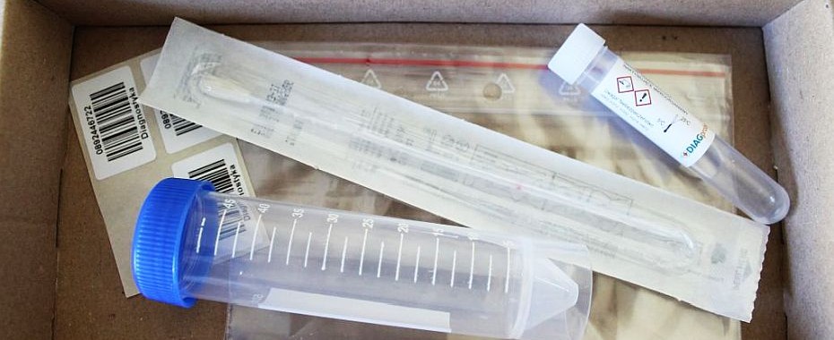 Test dla każdego zagrożonego zakażeniem