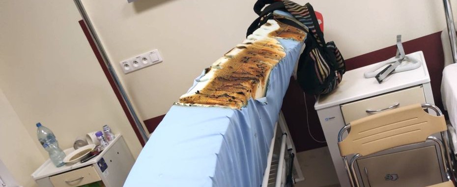 Ogień na oddziale chirurgii ogólnej szpitala